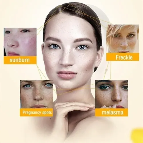 Pomada Reparadora Facial Blanquear Manchas Tratamiento
