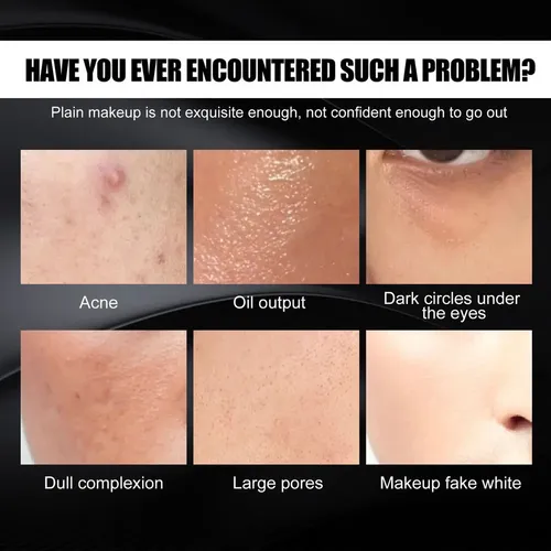 Crema Correctora Para Marcas De Acné Y Defectos
