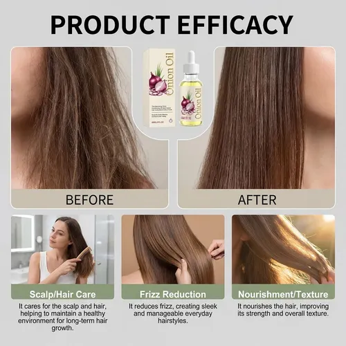 Onion Oil For Hair & Scalp, Natural Onion Oil Blend With