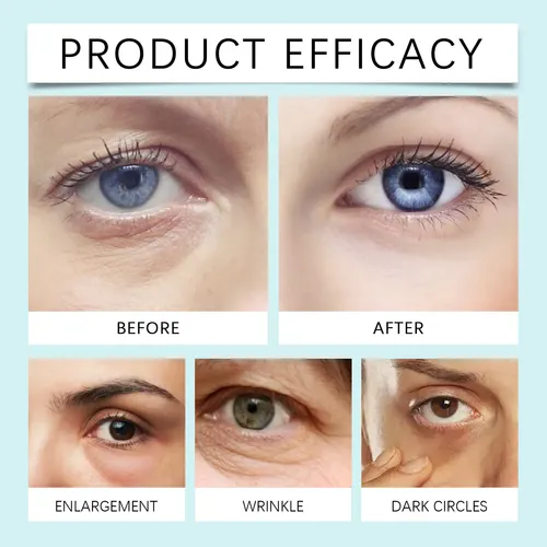 @crema Hidratante Para Ojos, Hidrata E Ilumina. #