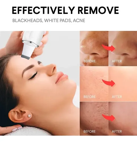 Exfoliante Facial, Limpieza De La Piel, Masaje Profundo Con