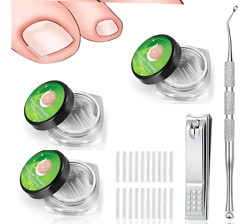 3 Mokasi Kit De Eliminación De Uñas Encarnadas, 150 Pcs .y