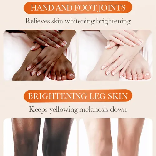 5.2oz Large Dark Knuckle Whitening Cream,skin Bleaching For