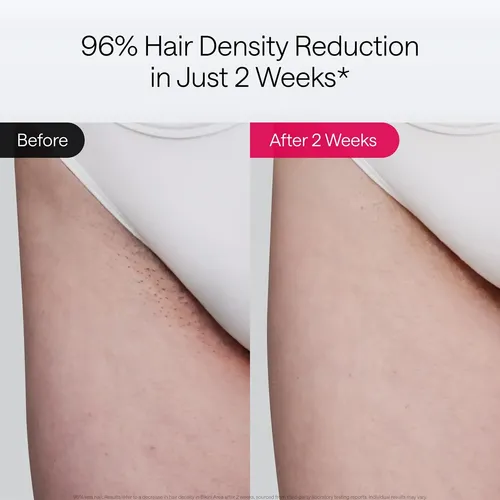 Depiladora Premium Lista Para Usar, Suave Con La Piel, Fácil