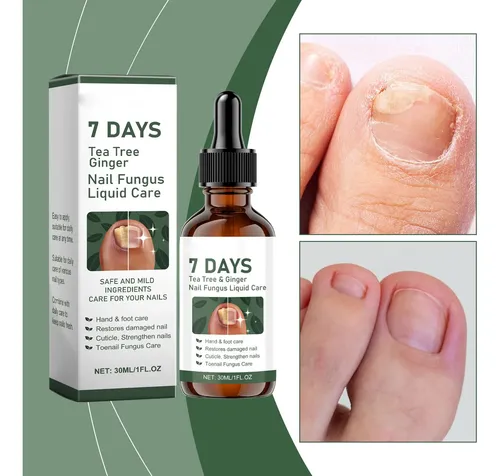 Solución Para El Cuidado De Uñas Reparadora 30ml