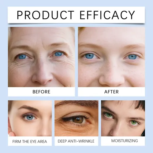 Parches Ojos Caffeine Antiedad Ojeras Tipo De Piel