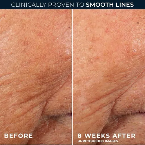 2.5% Retinol Serum Reduces Lines Firms Moisturizes 30ml