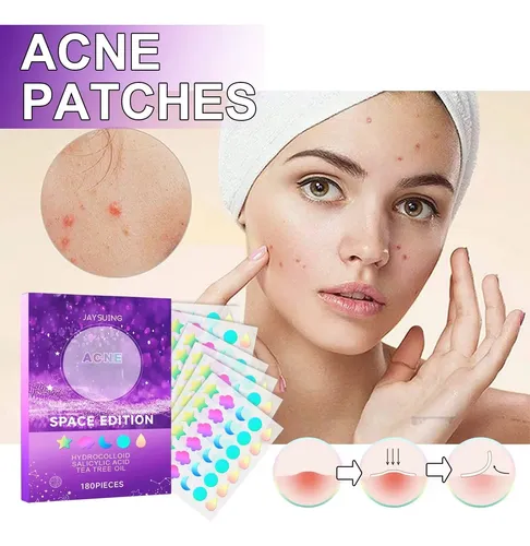 Acne Patches Space Edition Elimina Granitos, 180 Unidades
