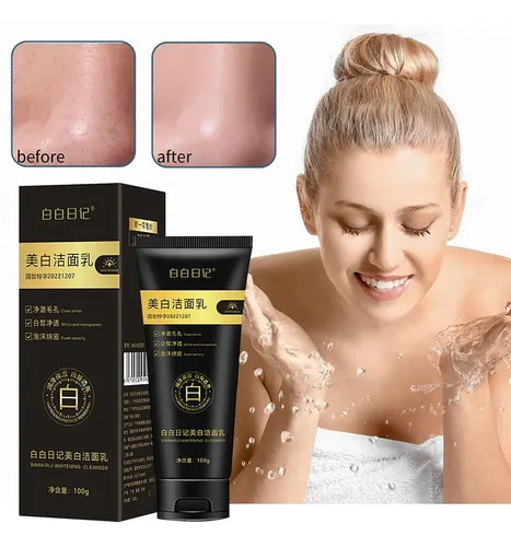 Limpiador Facial K Whitening Que Limpia E Hidrata El