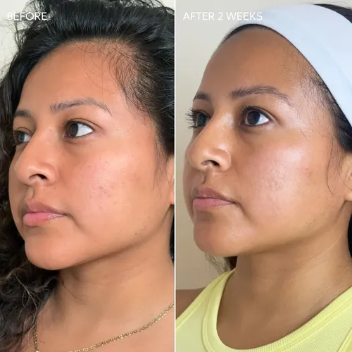Fycrema Correctora De Manchas Oscuras Dermisa Skin Fade Con
