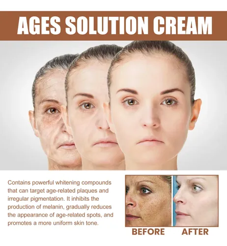 Crema Antimanchas, Antienvejecimiento, Iluminadora, Hidratan