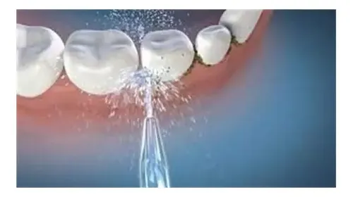 Boquillas Clásicas De Chorro Waterpik Para Limpieza Dental