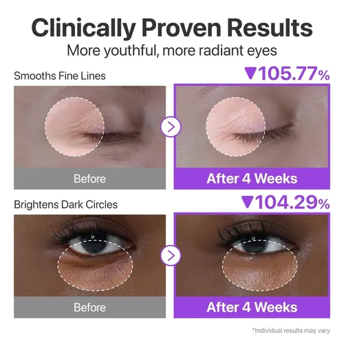 Bbcrema De Ojos Ssnumbuzin Con Retinol Hhff R