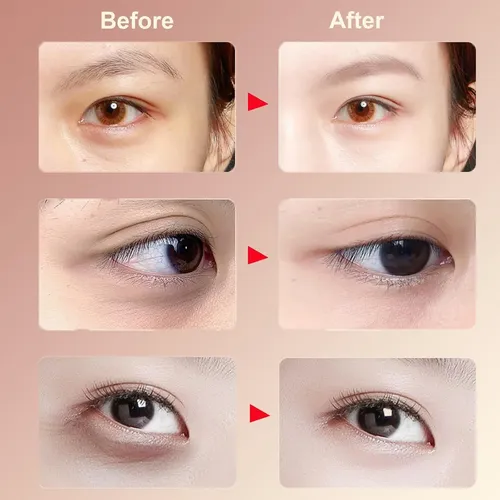Aceite Antiarrugas De Luteína De 8 Ml Que Mejora Las Ojeras  Madura Día/noche