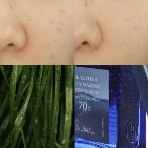 Dr.althea Aqua Marine Deep Serum 30ml