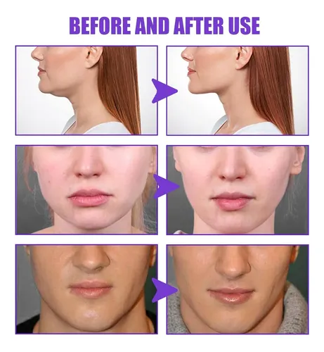 Crema Reafirmante Facial En Forma De V, 30 G, Hidratante Par