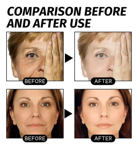 Mascarilla De Oro Con Retinol Que Limpia Profundamente Los