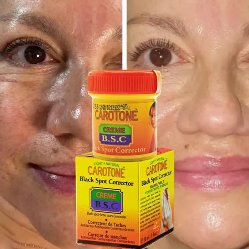 Crema Carotone B.s.c Corrector De Manchas 30 Ml Todo Tipo De Piel Día/noche