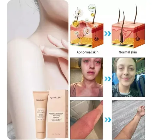 Exfoliante Y Purificante Quarxeri, Gel Exfoliante;