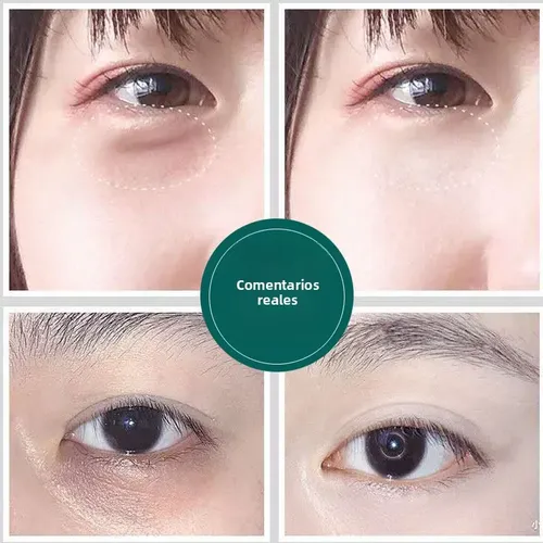 Parches De Gel Para Ojos Antiarrugas, Reduce Ojeras Y Bolsas