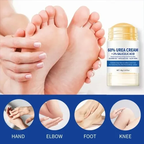 Crema Exfoliante Para Pies Con 60% De Urea, Crema Exfoliante