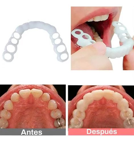 Funda Dental Flexible y Dentadura Cosmética Provisoria para Sonrisa Perfecta