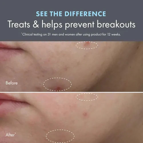 Crema Hidratante Origins Clear Improvement Acne 50 Ml Con Sa