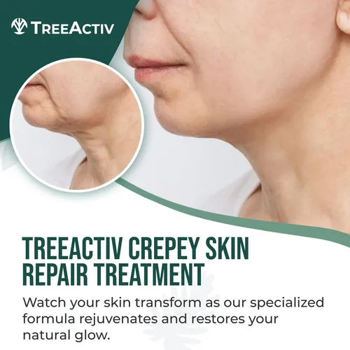 Treeactiv Crepey Skin Repair Crema Firmeza Cara Cuello
