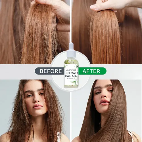Aceite De Romero Para Cabello Y Cuero Cabelludo