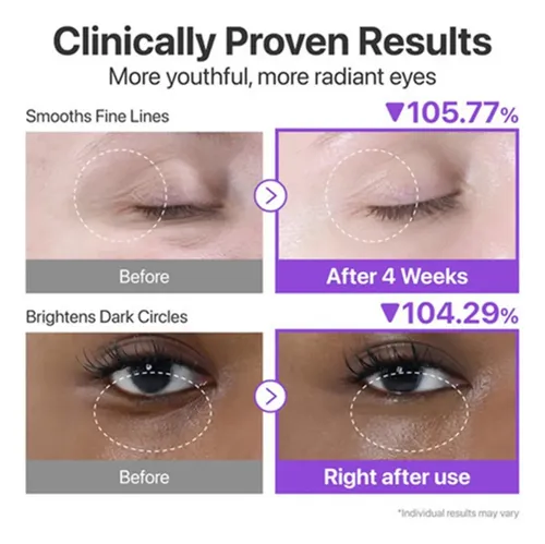 Paquete Tx 2: Crema Para Contorno De Ojos Con Volumen Con Cn