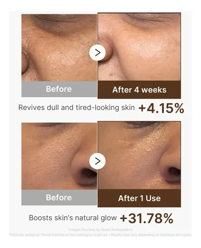 Medicube Deep Vitamin C Capsule Serum