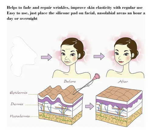 Eliminador De Arrugas Faciales, Almohadillas Para Arrugas En