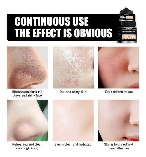 Mascarilla Facial De Carbón Para Puntos Negros