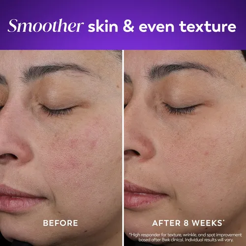 Crema De Noche Olay Retinol Para Mujer – Hidratante Antienve Día/noche