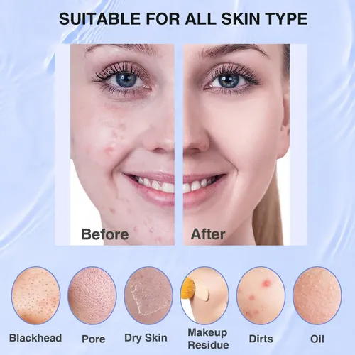 Limpiador Facial Silicona Eléctrico Impermeable 5 Modos Azul