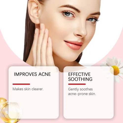 Crema Hidratante Facial Ouhoe Para Aliviar La Piel Seca