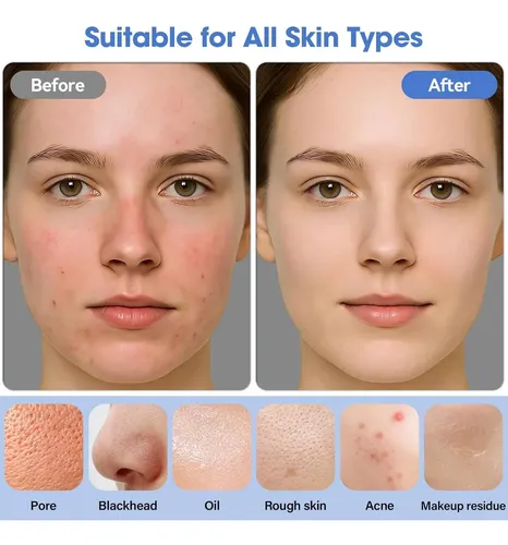 Limpiador Facial Eléctrico Recargable Con 6 Modos Y 3 Luces