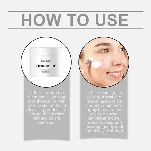 Pomada Facial Para Acné Ouhoe, Suave, Nutritiva Y Reparadora