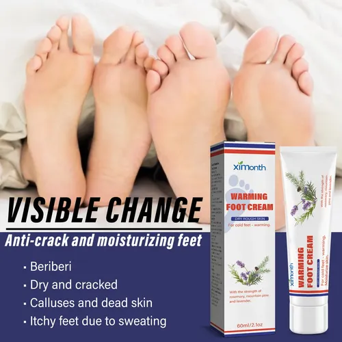 La Crema Para El Cuidado De Los Pies Ximonth Alivia E Hidrat