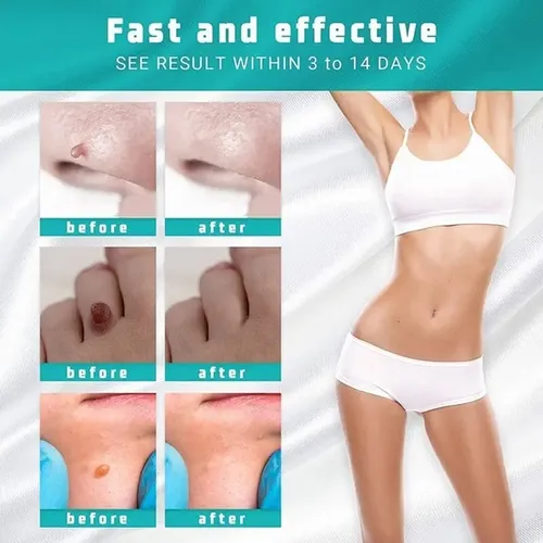 Crema Para La Eliminación Instantánea De Manchas Removedor