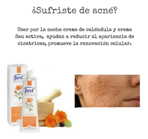 Crema De Caléndula Just Atenúa Estrías 25 Gramos