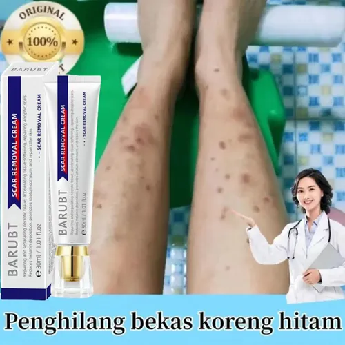 Hx La Crema Cicatricial Barubt All-english Protege La Piel Y