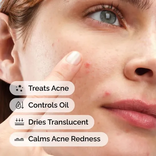 The Ordinary Azufre 10% Pó De Crema Para Acné 0.18 Oz