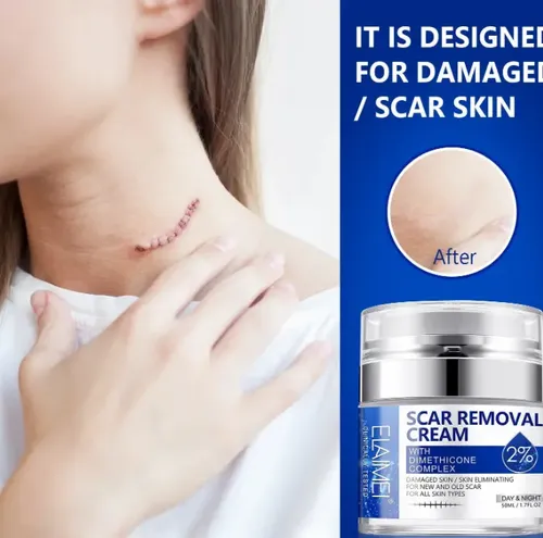Crema Reparadora Eliminadora De Cicatrices – Pomada Cicatriz