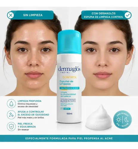 Dermaglós Espuma De Limpieza Control Piel Propensa Acné 150m Acneica Día/noche