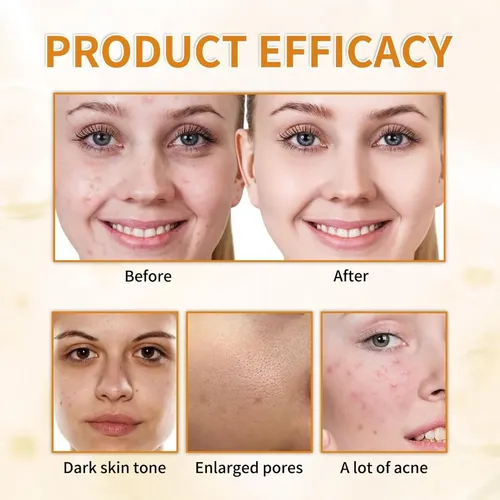 Tónico Facial Ácido Glicólico 7% Exfoliante 100 Ml Todo Tipo De Piel Día/noche