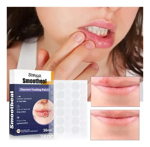 4parches Suavizantes For Herpes Labial Parche Curativo .