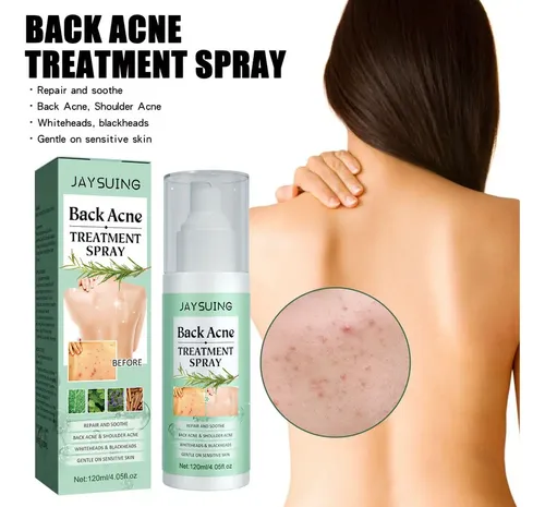 2×cura El Acné Espalda Con Ácido Salicílico Aceite Árb .