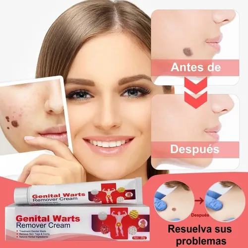 Crema For Eliminar Verrugas, Crema For La Pie