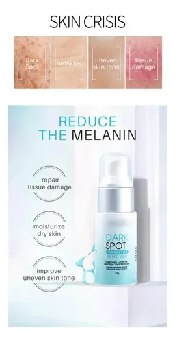 Crema Correctora De Manchas Oscuras Ideal Para Manchas